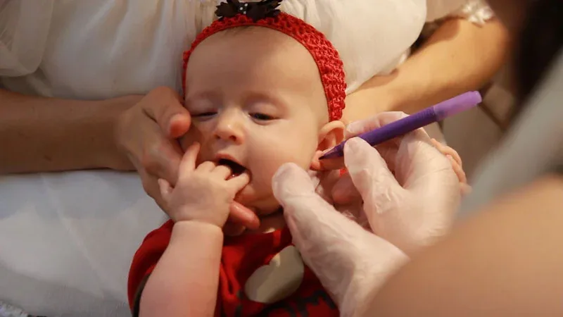 Baby in a red headband having an ear marked with a purple pen by gloved hands before a Karnavedha ear piercing